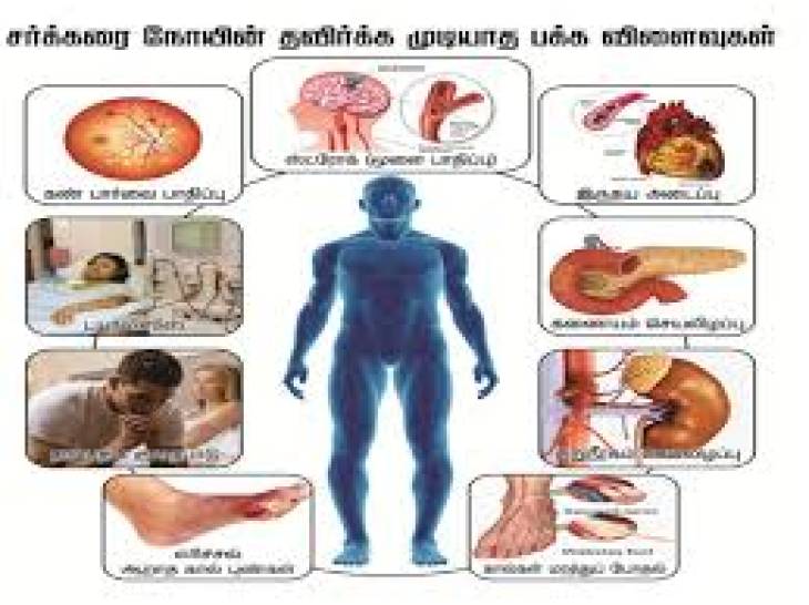 3500 ஆண்டுகள் வரலாறு கொண்ட டயபடீஸின் கதை!